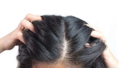 rambut rontok