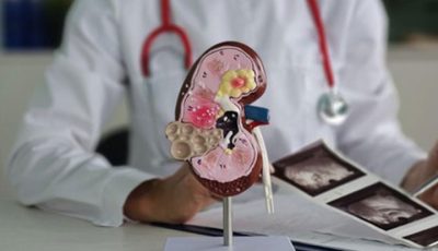 Ilustrasi organ ginjal dan pasien menjalani hemodialisis akibat gagal ginjal