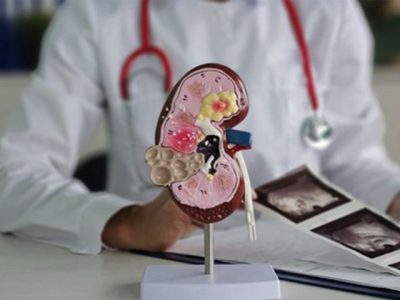 Ilustrasi organ ginjal dan pasien menjalani hemodialisis akibat gagal ginjal