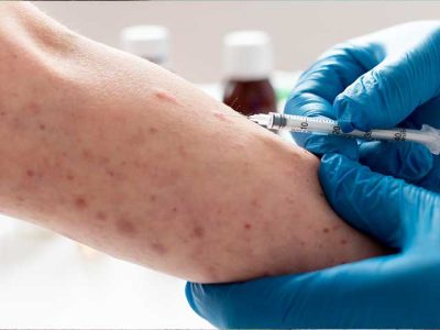 Petugas_kesehatan_memberikan_vaksin_MMR_di_Puskesmas